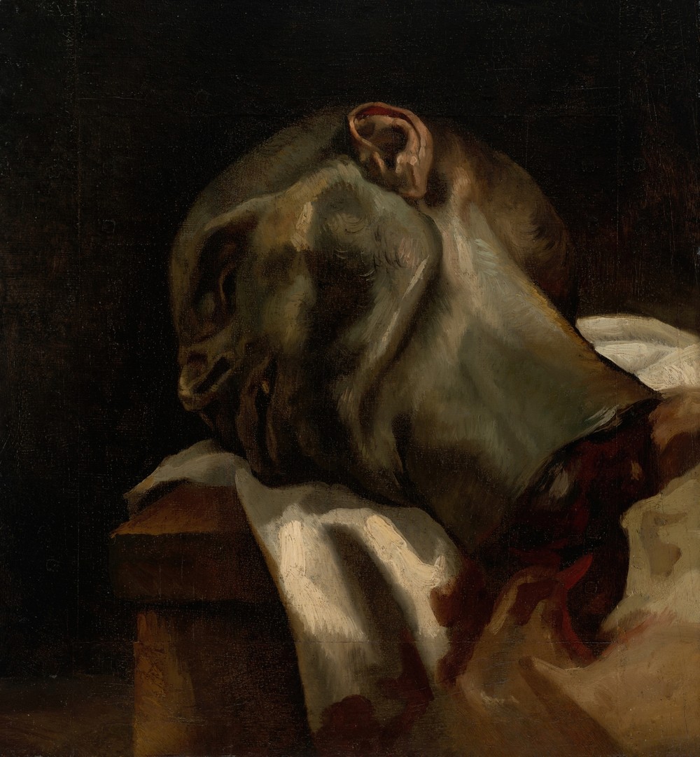Head of a Guillotined Man (1818-19)